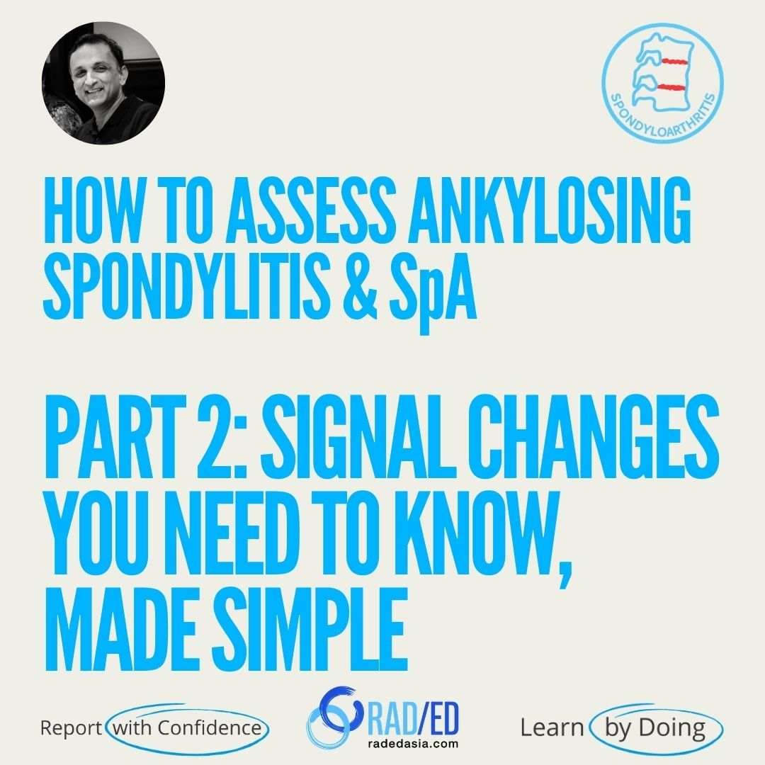 MRI signal changes in ankylosing spondylitis and axial spondyloarthritis, highlighting key inflammatory and structural findings.