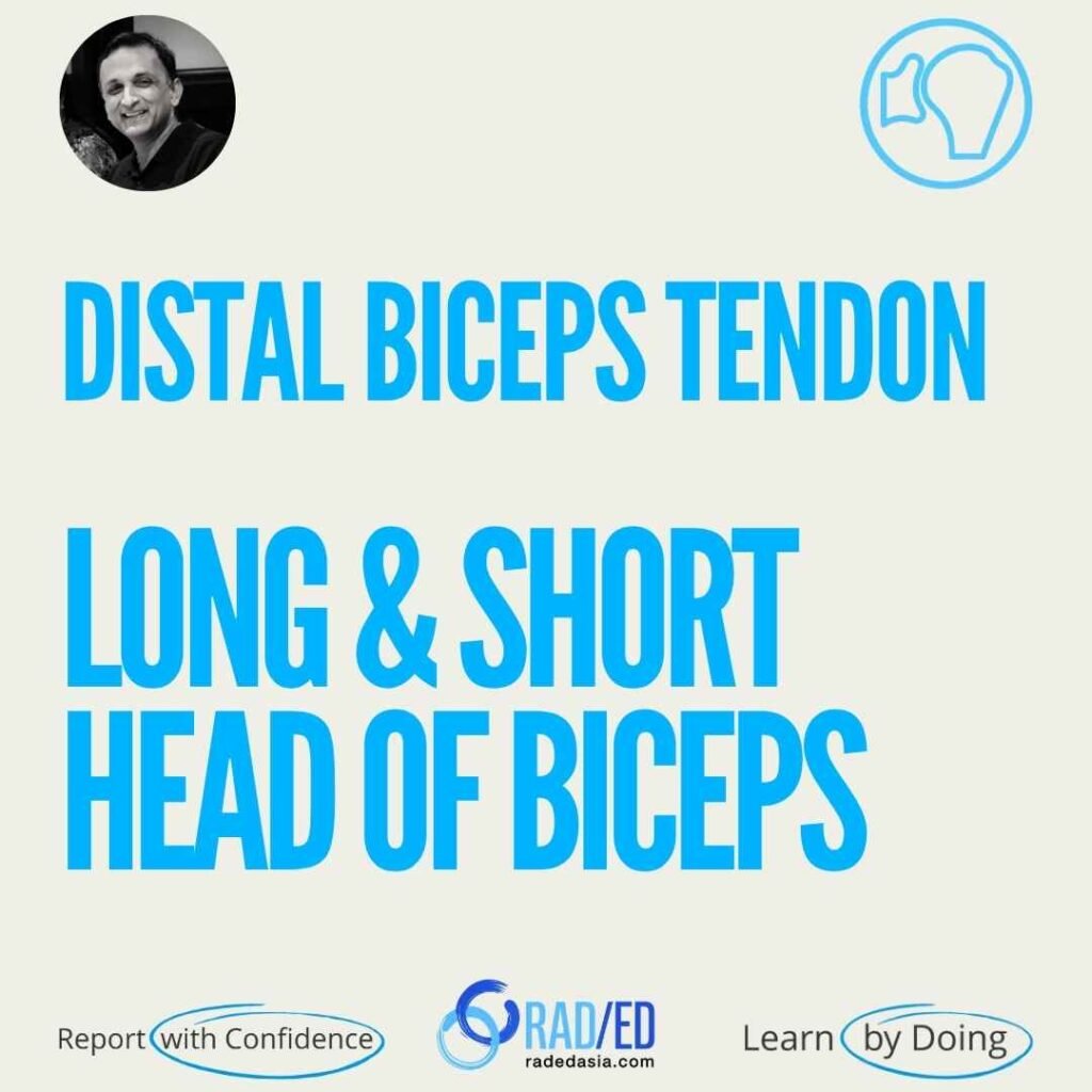 Distal biceps tendon anatomy with Long and Short Heads, tendonosis, tear, and rupture that can affect one head only.