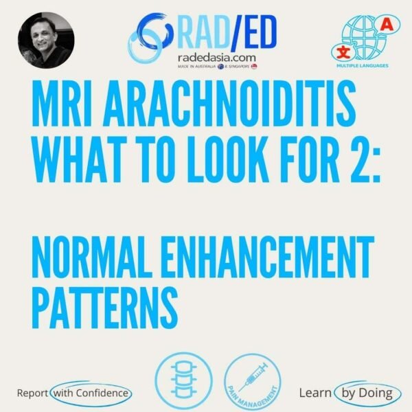 MRI arachnoiditis demonstrating normal post-contrast enhancement patterns of spinal nerve roots & meninges for accurate image interpretation.