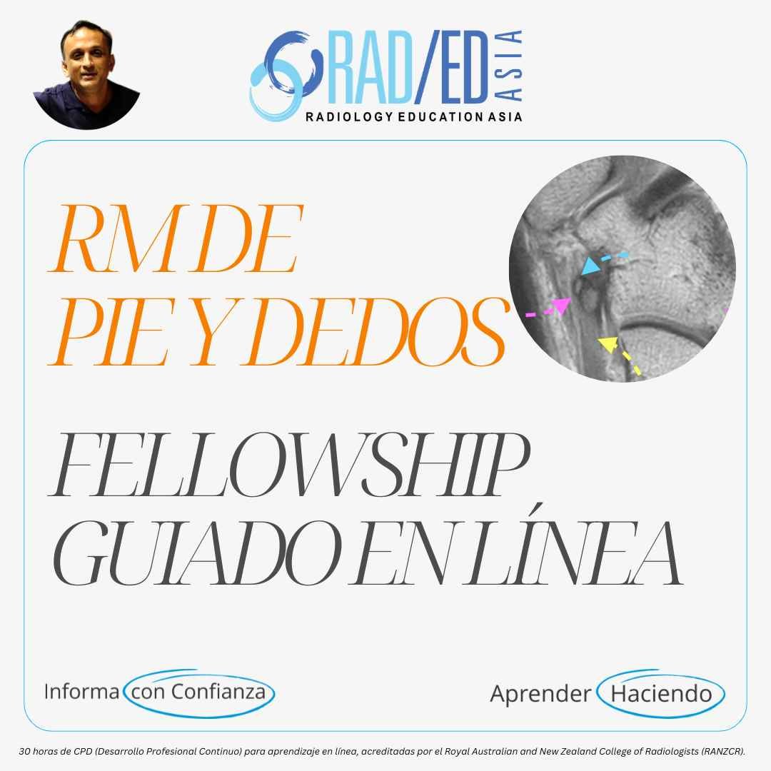 Mini-curso de formación en línea guiado sobre RM de tobillo y pie, impartido por Radiology Education Asia y acreditado para el desarrollo profesional continuo (CPD)