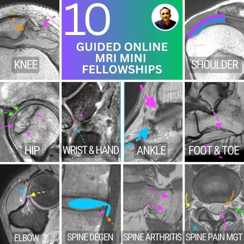 Online MSK and spine MRI mini fellowships – 10 guided courses with 30 CPD hours accredited by RANZCR.