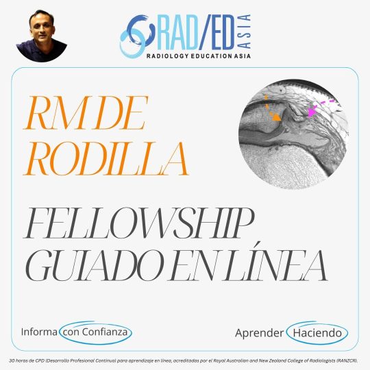 rodilla-mri-msk-online-musculoesquelético-curso-aprendizaje-radiología-imagen-radedasia Fellowship guiada en línea sobre RM de rodilla impartida por Radiology Education Asia con acreditación CPD (Desarrollo Profesional Continuo).