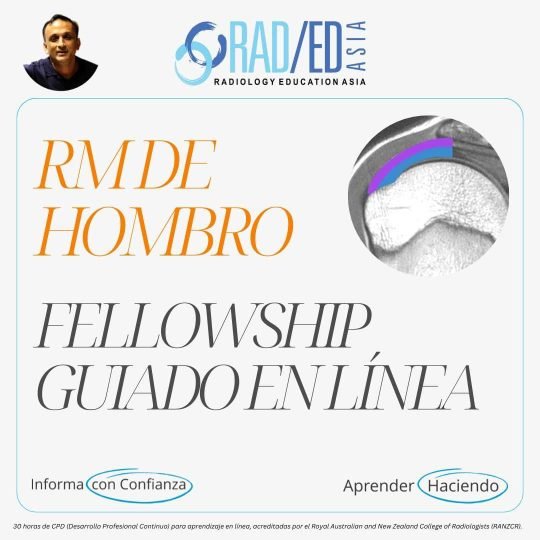 Fellowship guiada en línea sobre RM de Hombro impartida por Radiology Education Asia con acreditación CPD (Desarrollo Profesional Continuo).