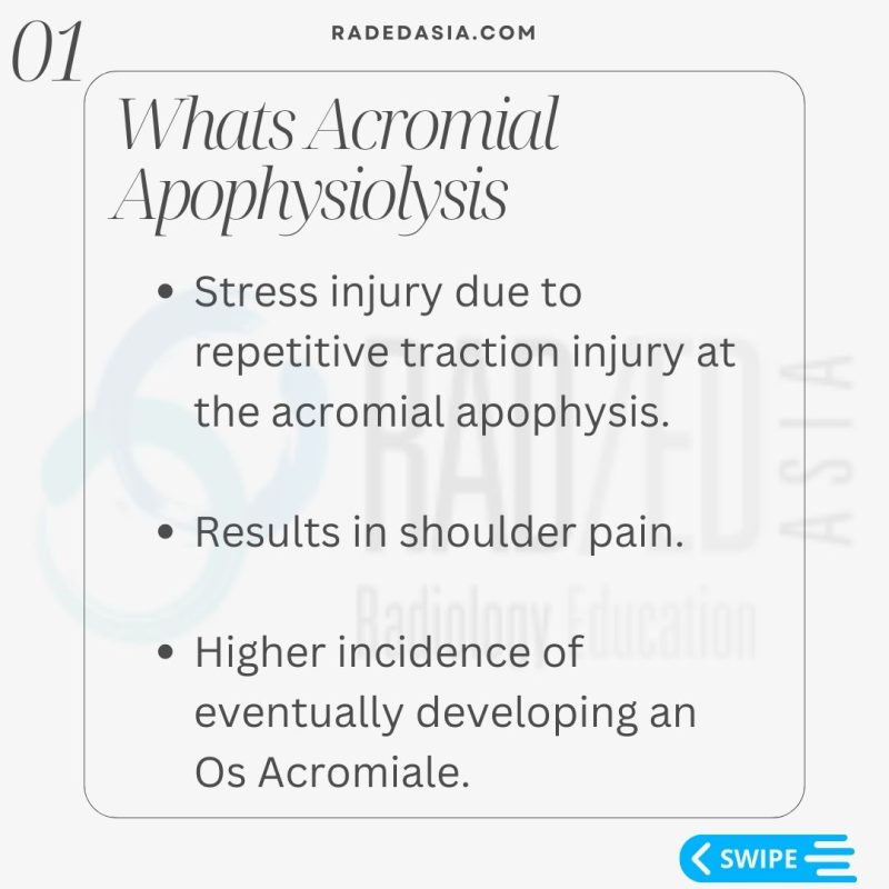 acromial-apophysitis-apophysiolysis-os-acromiale-radiology-mri-shoulder.jpg