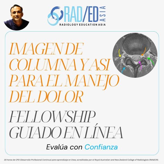Fellowship guiada en línea sobre imágenes de la columna vertebral y la articulación sacroilíaca para el tratamiento del dolor impartida por Radiology Education Asia con acreditación CPD (Desarrollo Profesional Continuo).