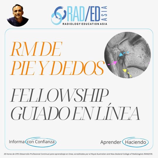 Fellowship guiada en línea sobre RM de Pie y Dedos impartida por Radiology Education Asia con acreditación CPD (Desarrollo Profesional Continuo).