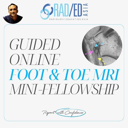 foot-toe-mri-msk-online-musculoskeletal-ankle-course-learn-radiology-imaging-radedasia-rea