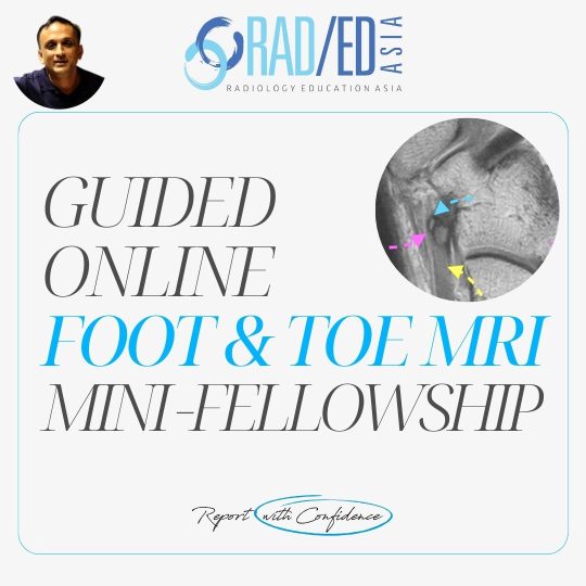 foot-toe-msk-ankle-mri-online-musculoskeletal-course-learn-radiology-imaging-radedasia-1