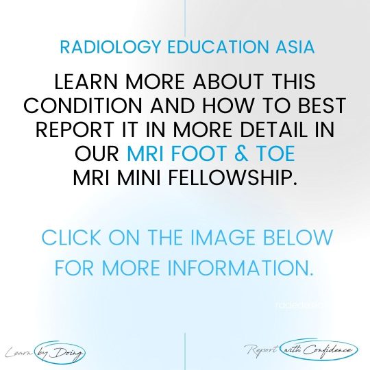 foot-toe-msk-mri-learn-radiology-online-course-radedasia.jpg