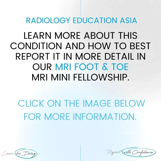 foot-toe-msk-mri-learn-radiology-online-course-radedasia.jpg