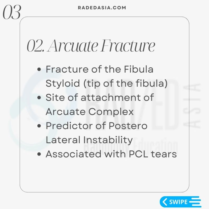 knee-lateral-fibular-segond-arcuate-fracture-xray-mri.jpg