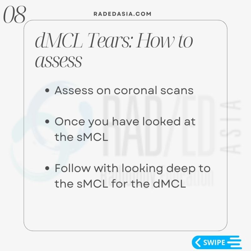 knee-mri-msk-musculoskeletal-deep-mcl-meniscotibial-ligament-tear-dmcl.jpg