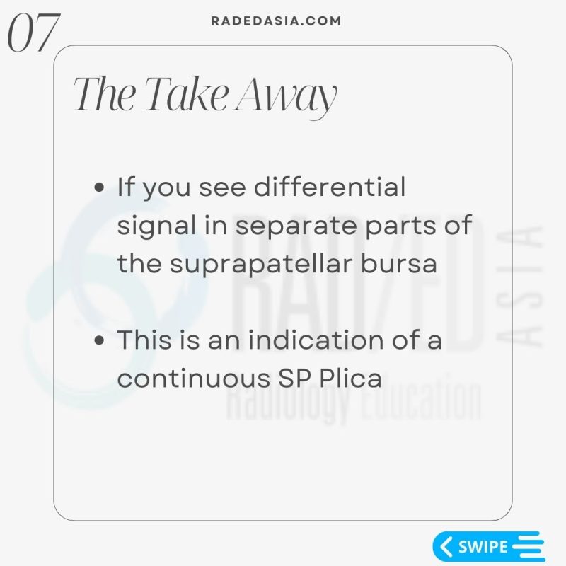 knee-mri-msk-musculoskeletalsuprapatellar-bursa-plica.jpg