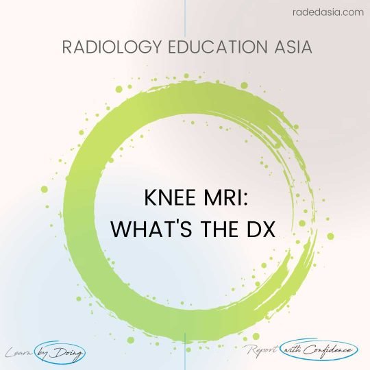 learn knee mri msk radiology online radedasia