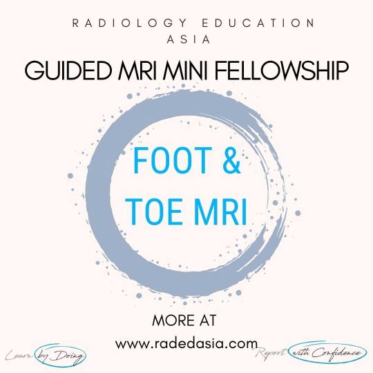 learn-mri-foot-toe-msk-radiology-online-radedasia.jpg