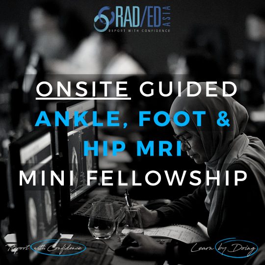 learn-mri-radiology-foot-toe-ankle-msk-imaging-radedasia.jpg