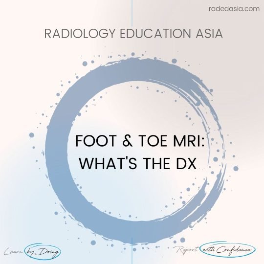 learn mri radiology foot toe intro circle radedasia