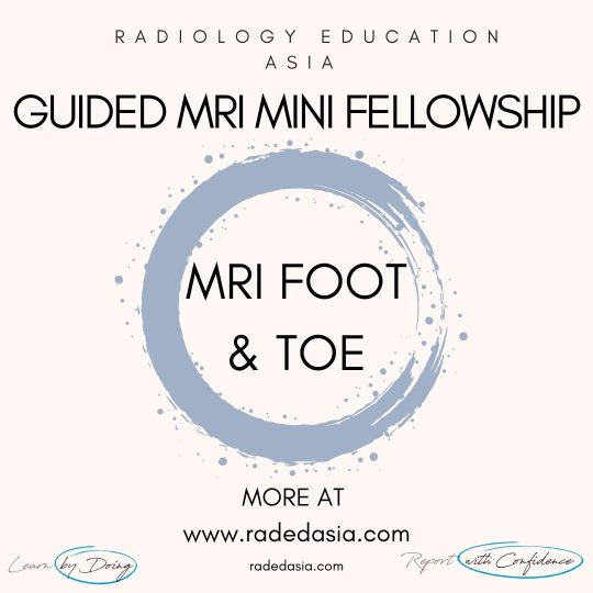 learn-mri-radiology-foot-toe-radedasia.jpg