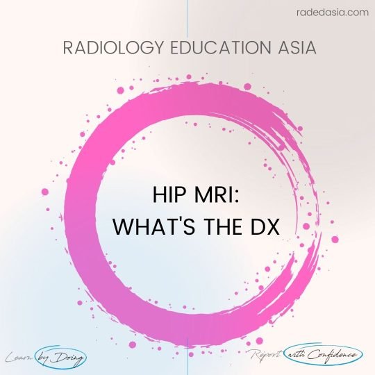 learn mri radiology hip intro circle radedasia