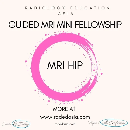 learn-mri-radiology-hip-radedasia.jpg