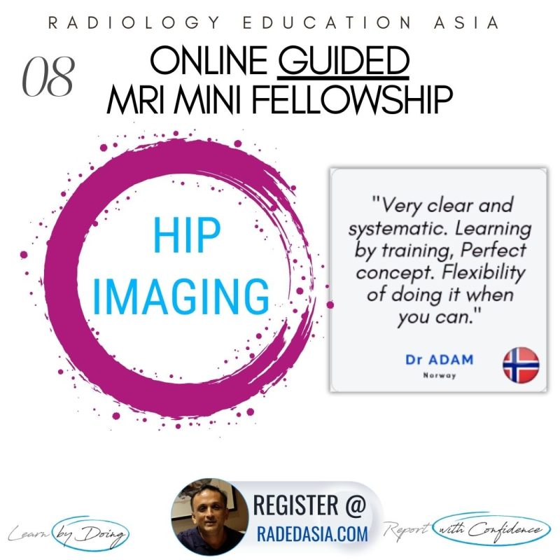 mri-hip-learn-musculoskeletal-msk-mri-radedasia.jpg