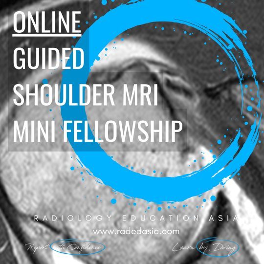 msk-radiology-guided-online-mri-shoulder-radiology.jpg