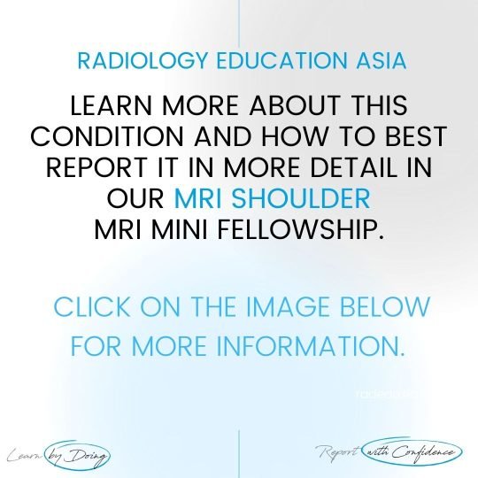 shoulder msk mri learn radiology online course radedasia