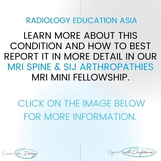 spine sij arthropathies mri learn radiology online course radedasia