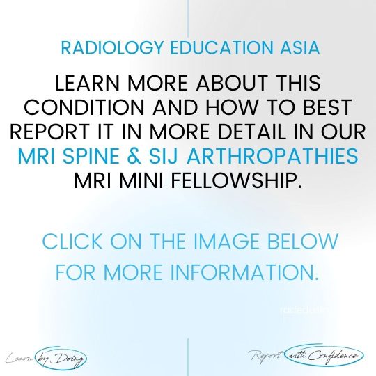 spine-sij-arthropathies-mri-learn-radiology-online-course-radedasia.jpg