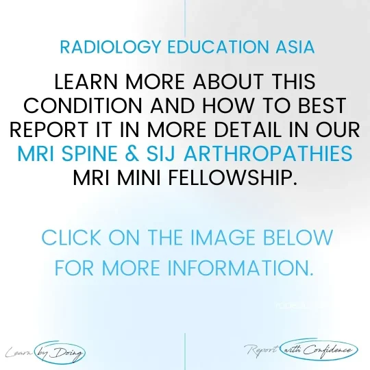 spine-sij-arthropathies-mri-learn-radiology-online-course-radedasia.jpg