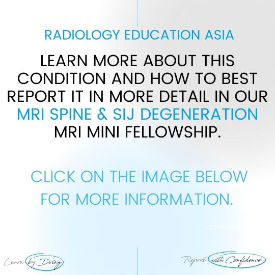 spine-sij-degen-mri-learn-radiology-online-course-radedasia.jpg