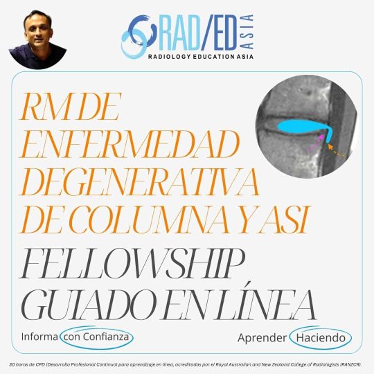 columna vertebral-enfermedad-degenerativa-rm-curso en línea-aprender radiología-imágenes-tc-ct-rayos X-radedasia Fellowship guiada en línea sobre la enfermedad degenerativa de la columna vertebral impartida por Radiology Education Asia y acreditada por el CPD.