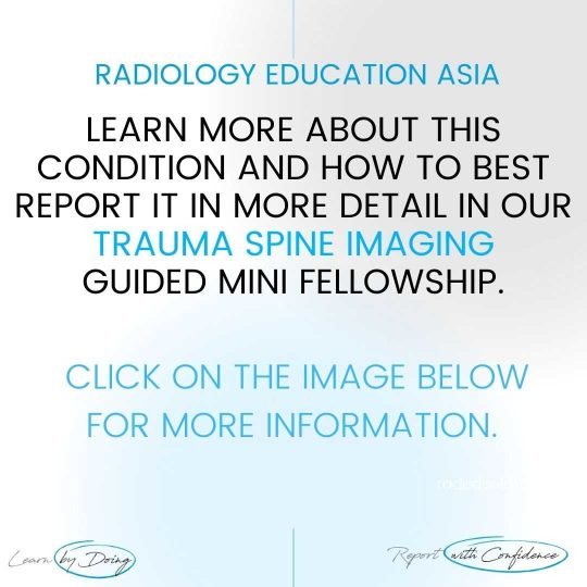 spine-trauma-imaging-learn-mri-radiology-online-course-radedasia.jpg