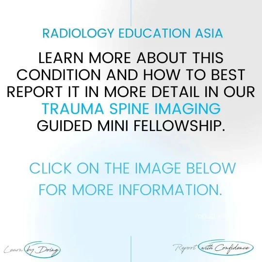 spine-trauma-imaging-learn-mri-radiology-online-course-radedasia.jpg