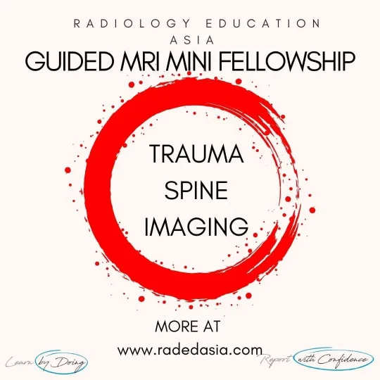 spine-trauma-radiology-learn-imaging-online-radedasia.jpg