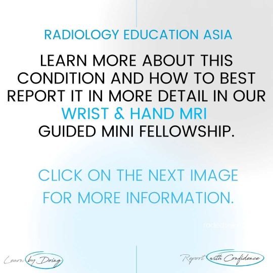 Learn msk wrist hand fingers mri radiology online course by radedasia